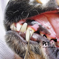 Скалер для чистки зубов двухсторонний Скалер для чистки зубов двухсторонний